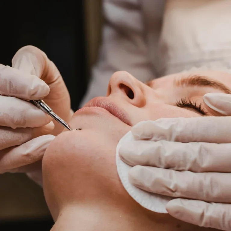 Dermaplaning Treatment