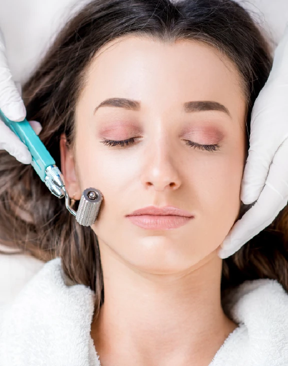 Dermaroller Treatment