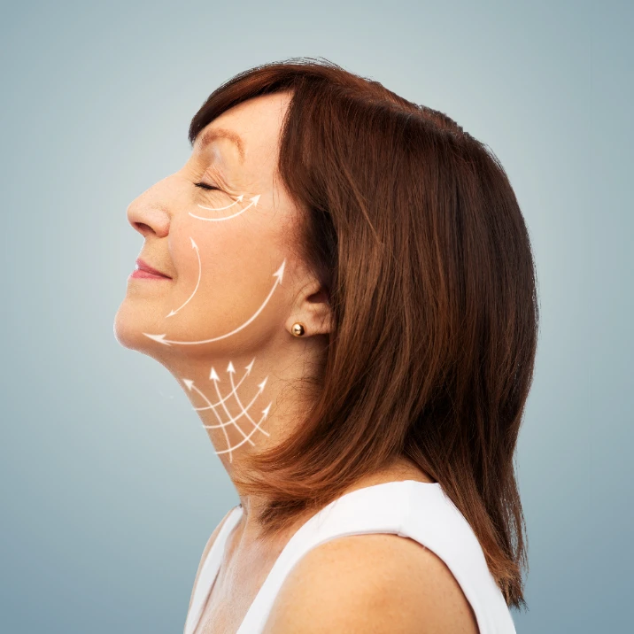 Non-surgical face lift