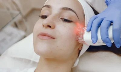 CO2 Fractional Laser Treatment