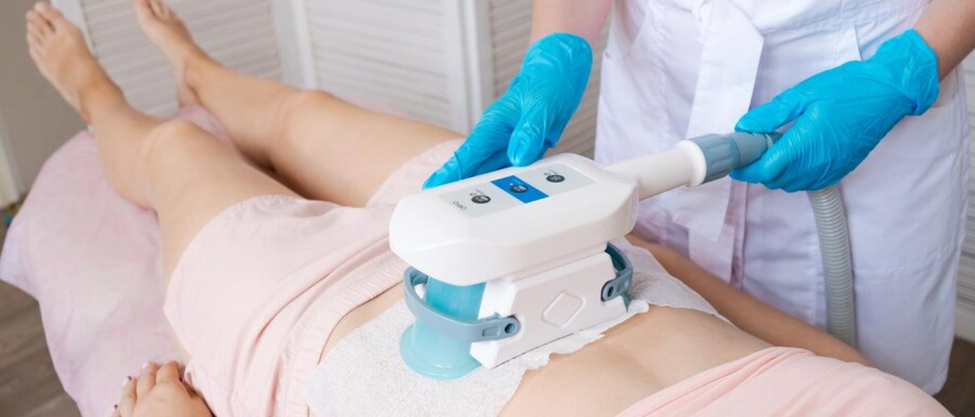 CoolSculpting Treatment