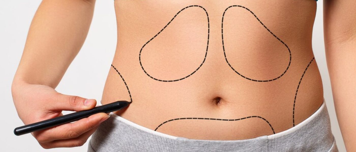 Figure Correction
