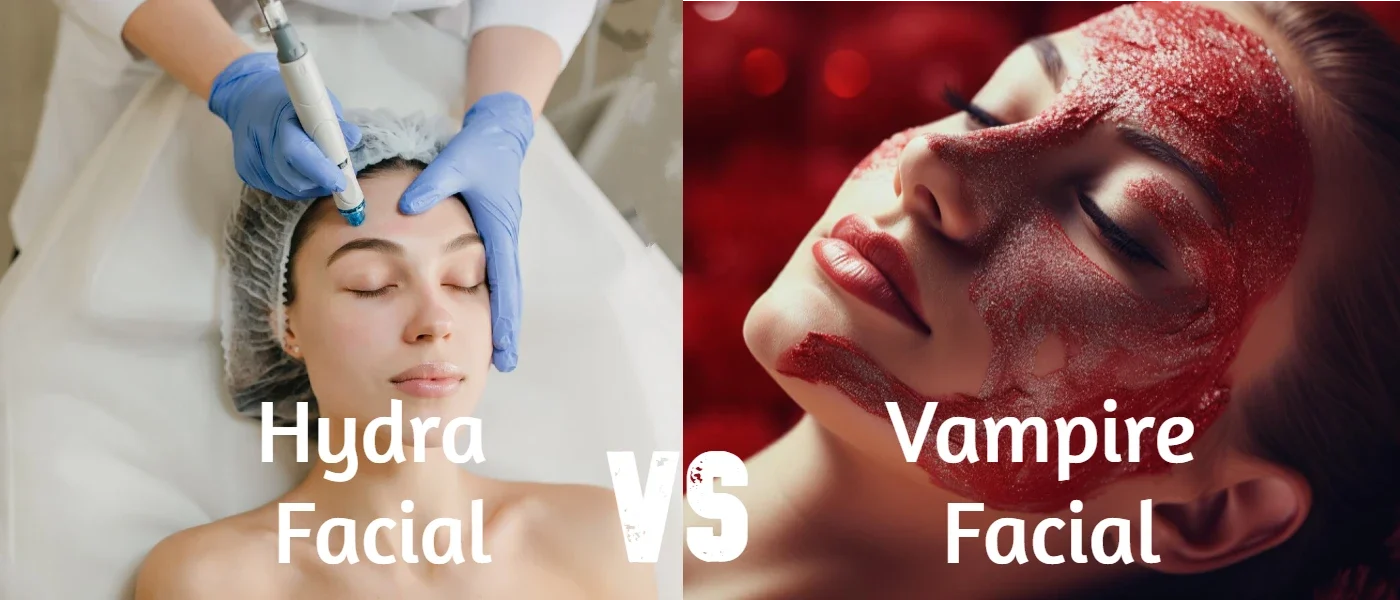 Hydra Vs Vampire Facial