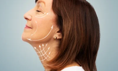 Non-surgical face lift