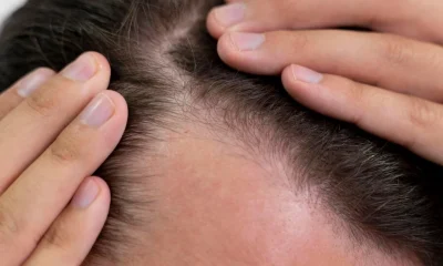 QR678 hair treatment