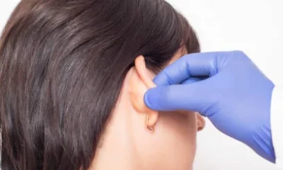 Auroplasty Surgery